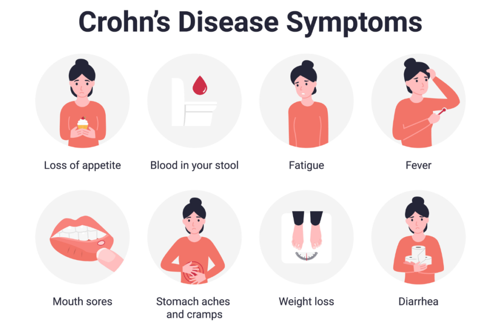 Crohn's Disease Crohns Disease